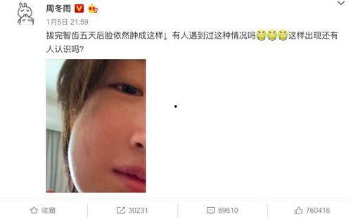 你爆料我吃瓜短剧免费观看